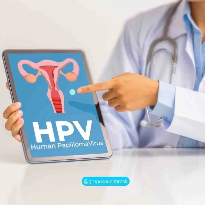 HPV Tipos de vacina e quem pode tomar